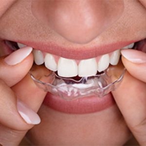 Tratamientos odontología